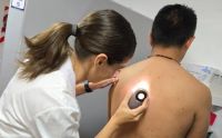 Vacuna experimental contra el cáncer de piel tuvo resultados positivos