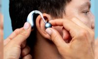 Implantes cocleares: qué cambian estos dispositivos para la audición