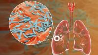 Desarrollan una estrategia innovadora para acortar tratamiento contra la tuberculosis