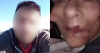 “Morite” y “te rompo la cabeza”: cuidador de geriátrico acusado de maltratar a dos adultas mayores